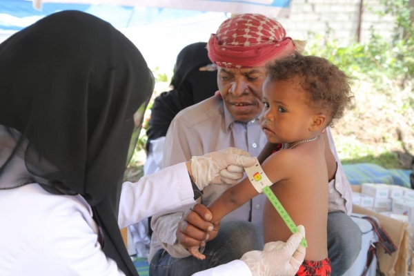 الصحة العالمية: ثلاثة من كل أربعة أطفال في اليمن يعانون سوء التغذية