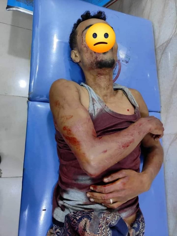 مقتل وإصابة 6 أشخاص إثر اشتباكات على قطعة أرض في عدن