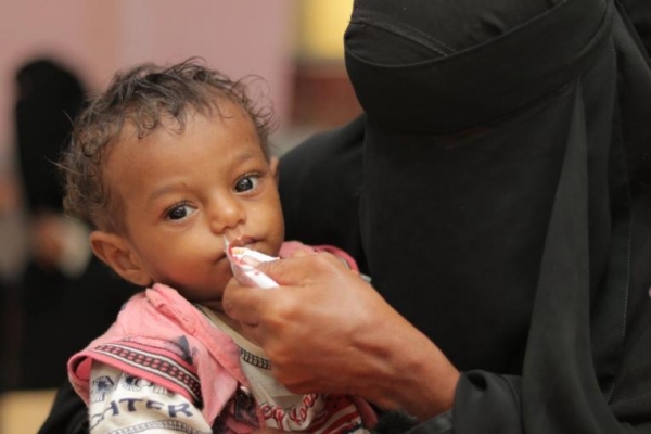 الأمم المتحدة: أكثر من 11 مليون طفل يمني بحاجة للمساعدات منهم 2.2 مليون طفل يعانون سوء التغذية