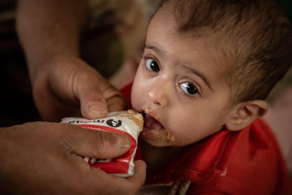 الأمم المتحدة تخصص 18 مليون دولار لمعالجة مستويات انعدام الأمن الغذائي في اليمن