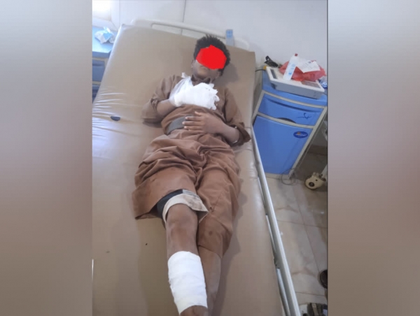 إصابة طفل بجروح نتيجة انفجار مقذوف من مخلفات الحرب في مارب