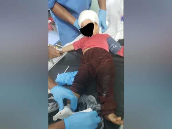 إصابة ثلاثة أطفال أشقاء بانفجار جسم حربي في الضالع