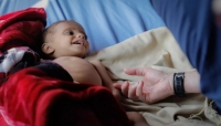 الصحة العالمية تعلن تسجيل نحو 240 حالة إصابة بفيروس شلل الأطفال باليمن